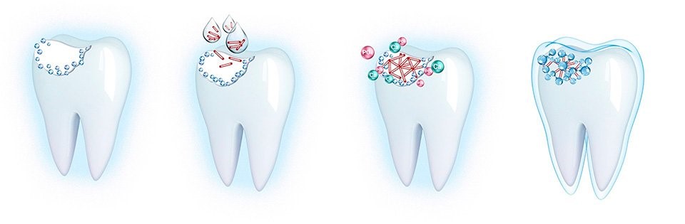 Этапы реминерализации зубов